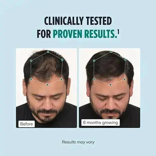 Nutrafol Men ingredients